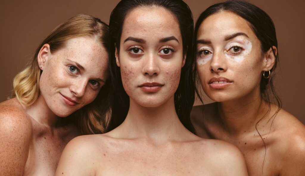 Close up of women with diverse skin types.